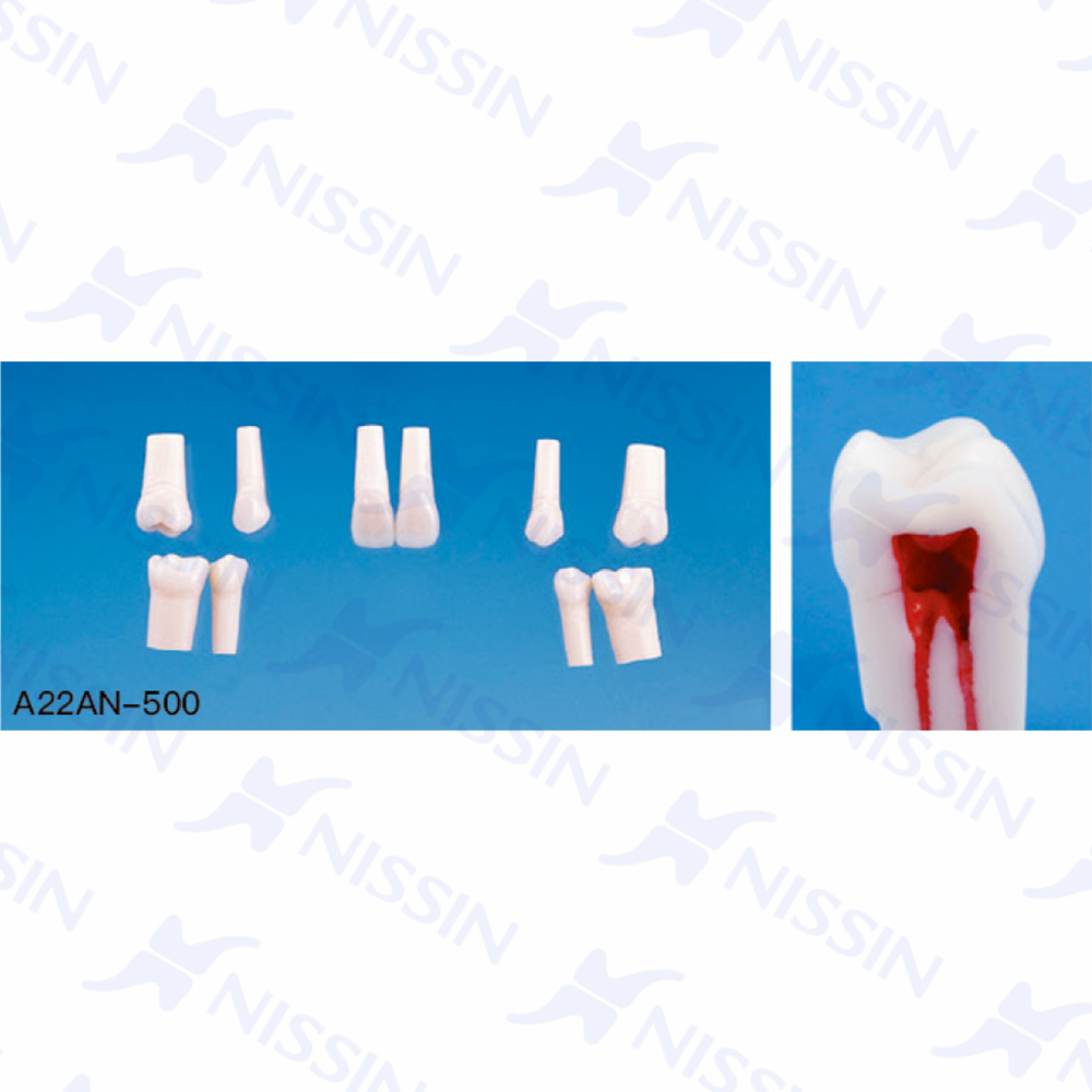 帶髓腔的復合樹脂牙