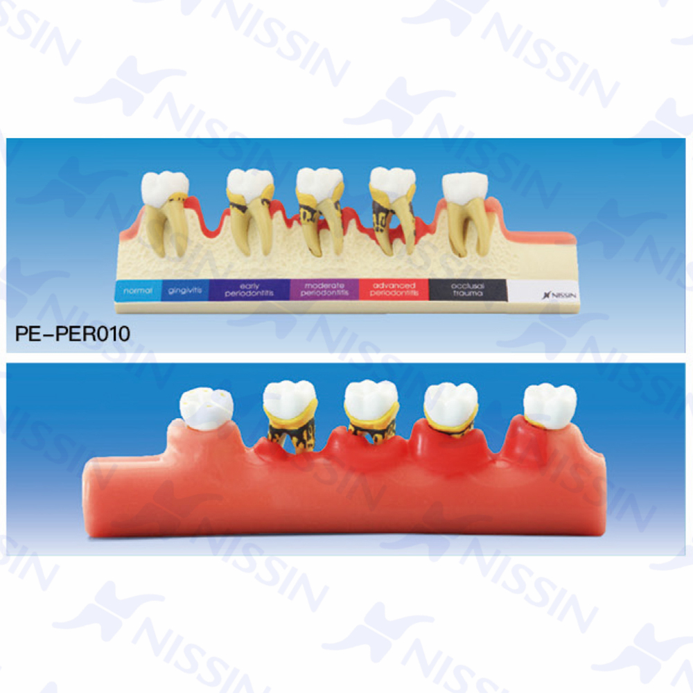 牙周病分類(lèi)模型